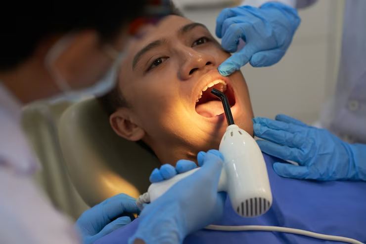 How Long Do You Have To Wait After Dental Removal