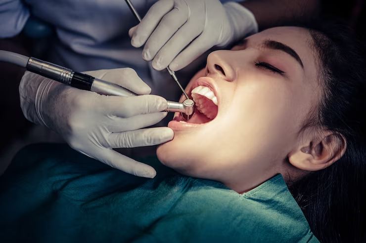 What Are The Influencing Factors After Tooth Extraction?