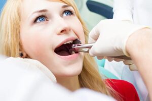 Everything You Need to Know About Wisdom Teeth Extraction